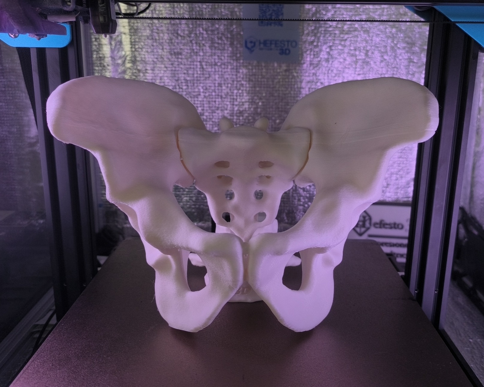 Pelvis completa — vista lateral